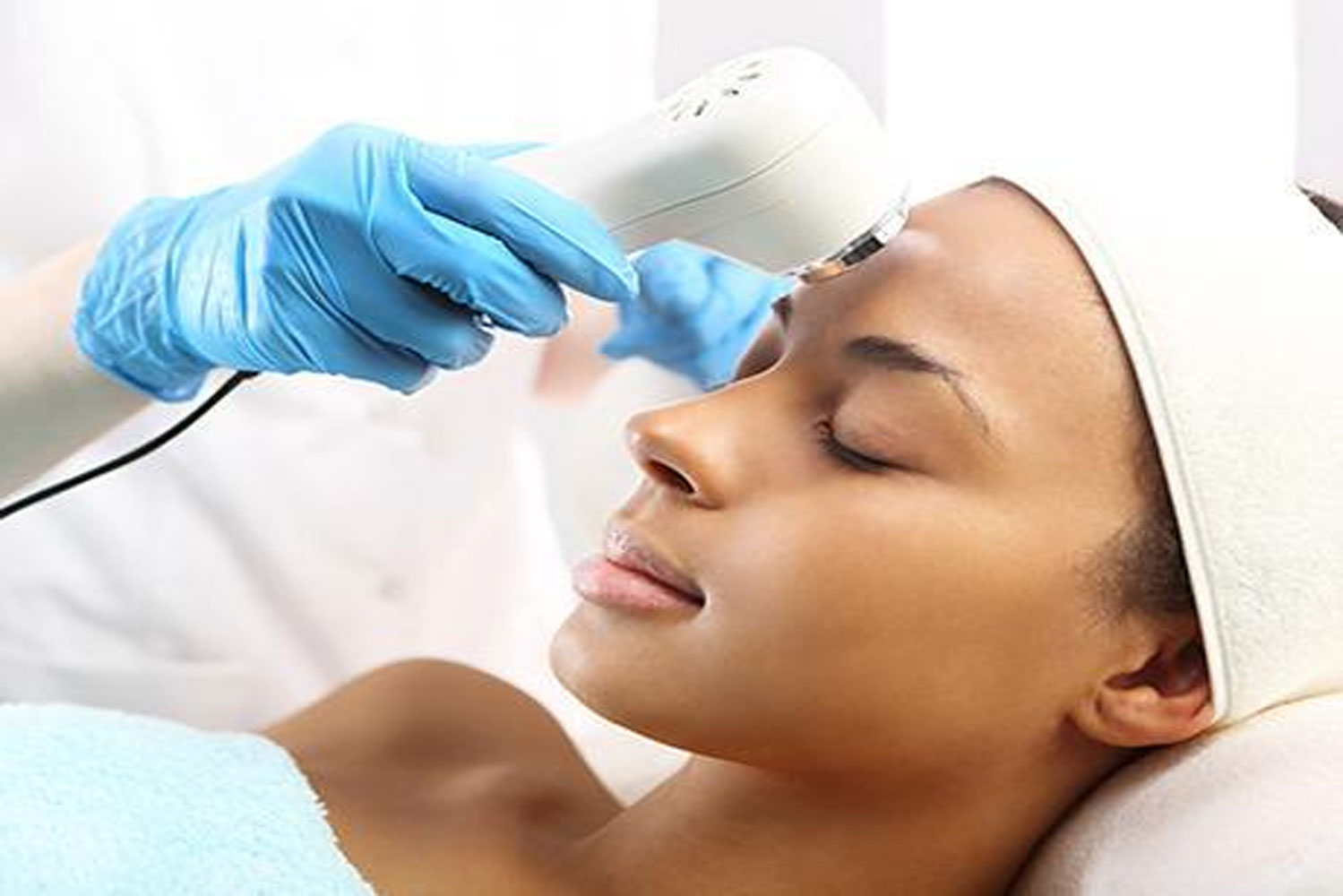 CO2 Laser on Face