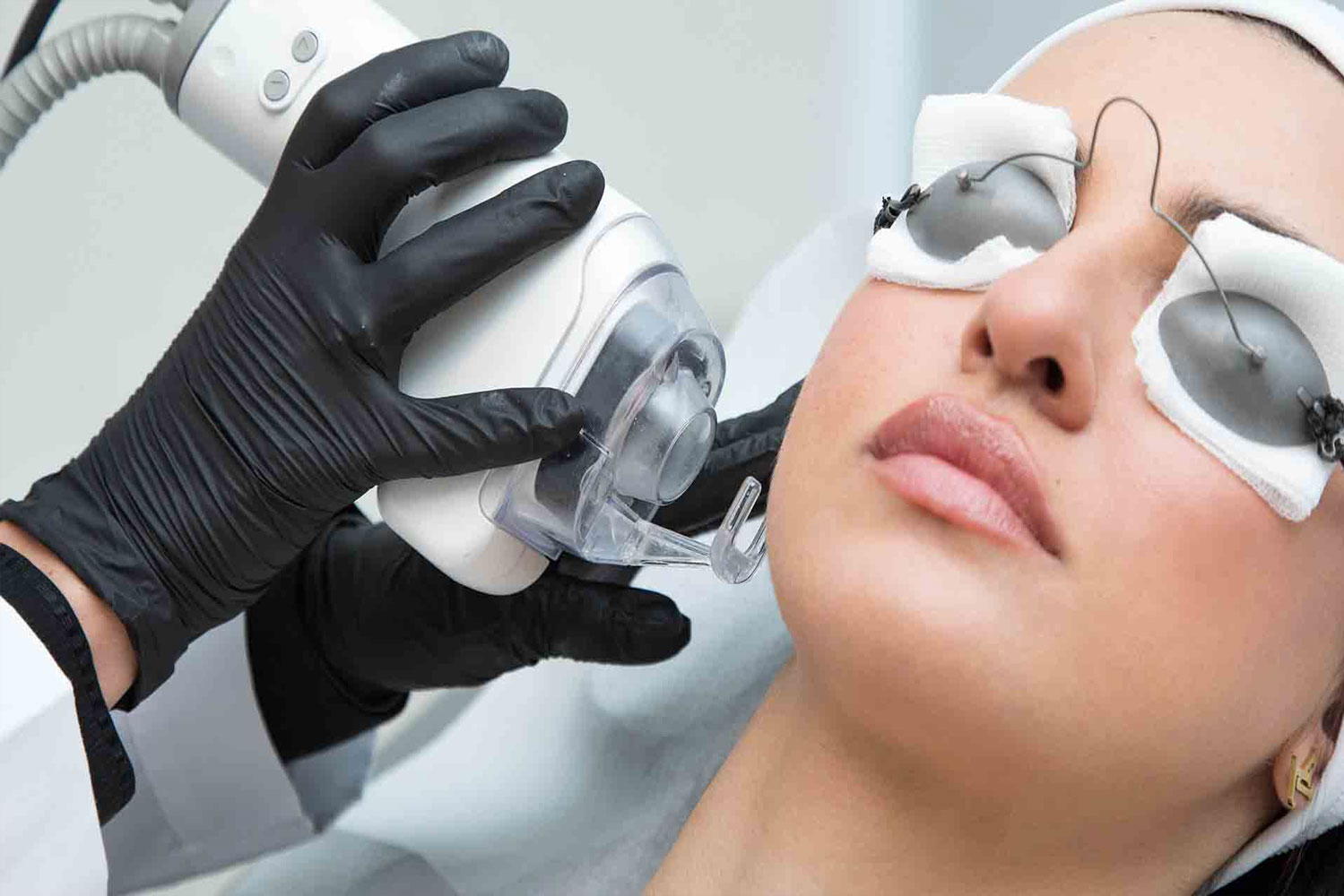 CO2 Laser Results